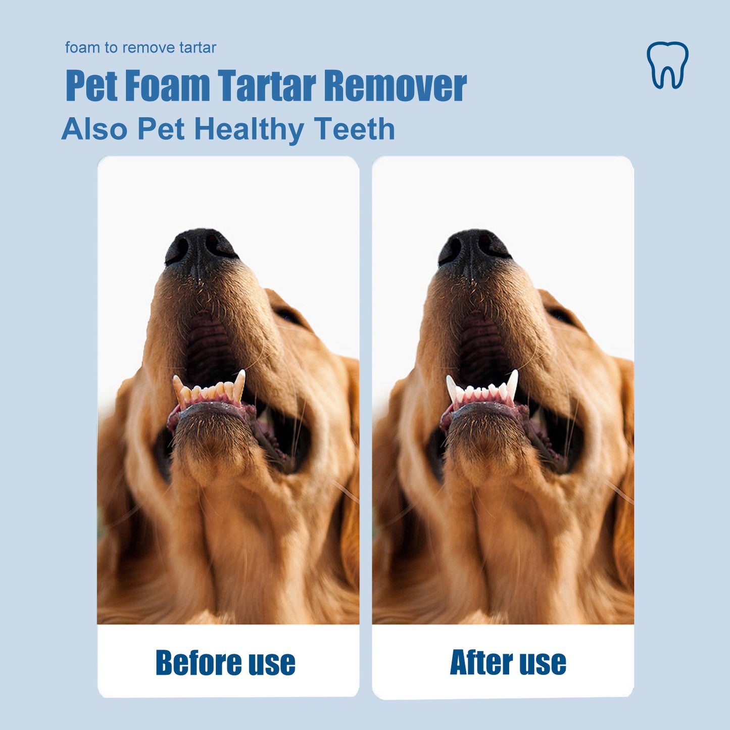 Dental Foam Cleaner For Removing Calculus, Yellow Teeth, Bad Breath, Teeth Cleaning