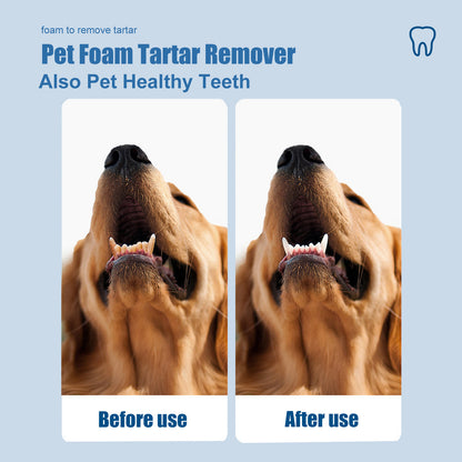 Dental Foam Cleaner For Removing Calculus, Yellow Teeth, Bad Breath, Teeth Cleaning